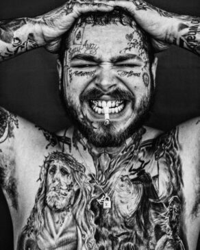 O rapper de 25 anos colocou dois dentes de diamantes, no total de US$ 1,6 milhão