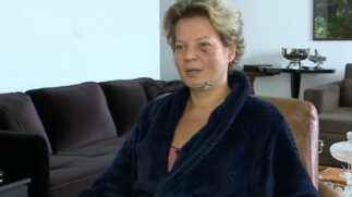 Joice relata incidente no qual teve cinco fraturas no rosto, uma na coluna e diversos hematomas