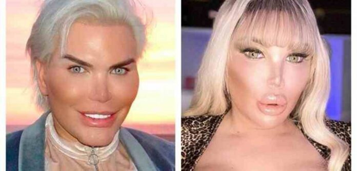 Jessica Alves, 38, que ficou famosa após passar por mais de 70 cirurgias plásticas para se tornar o Ken Humano.