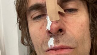 Liam Gallagher