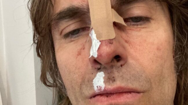 Liam Gallagher