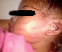 Prefeitura de São José dos Campos afasta três funcionários após acusação de agressão contra criança em creche