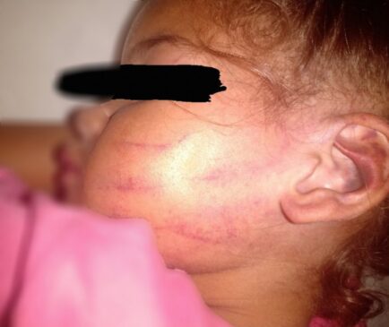 Prefeitura de São José dos Campos afasta três funcionários após acusação de agressão contra criança em creche
