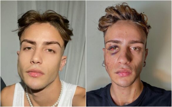 Jovem diz ter sido agredido por médico durante convulsão em hospital de Salto, no interior de SP